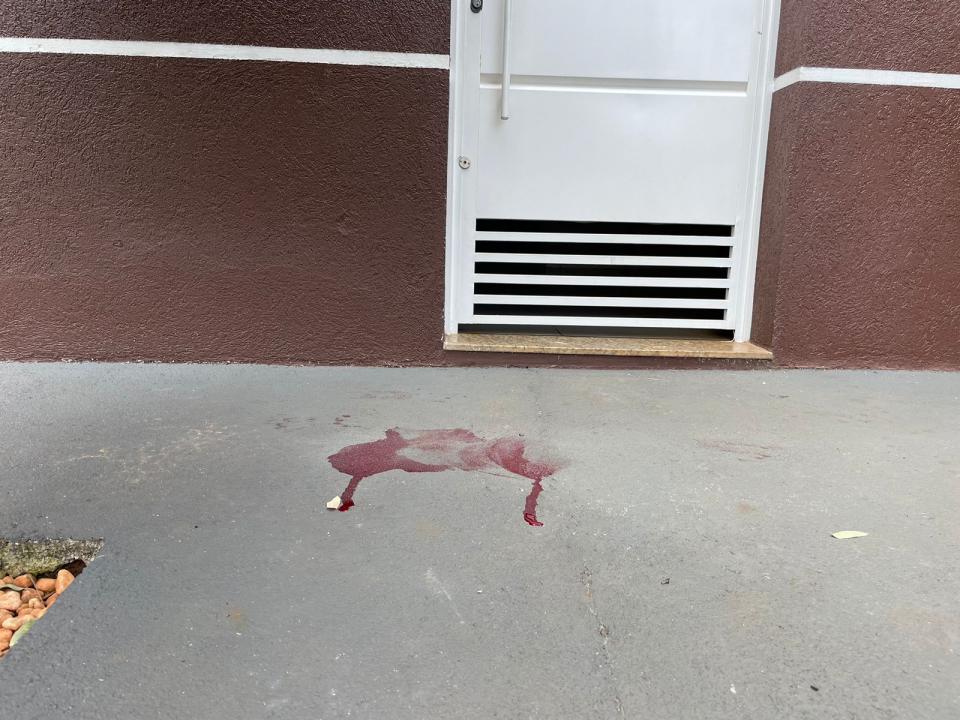 Foto 2 de 3 — Jovem leva tiro da PM durante fuga em Araraquara